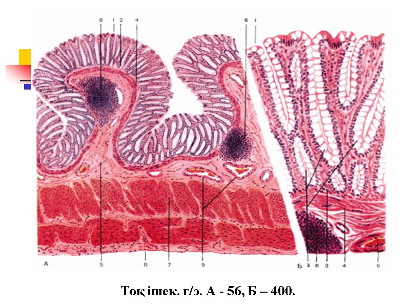 Тоқ ішек. г/э. А - 56, Б – 400.